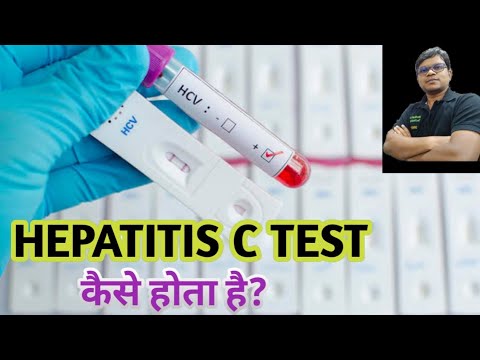 Video: Krvni Test Hepatitisa C: Kdo Bi Moral Biti Testiran