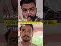 सिर्फ 15 दिन में चेहरा इतना बदल गया 😳🤩 #productreview #suro_reviews #honestreview #viralvideo
