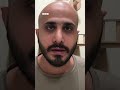 "رعاية القطط غيرت من شخصيتي" الشاب محمد عبد الله يتحدث عن تربيته لقطط تعاني من أمراض مزمنة
