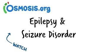 Epilepsy 