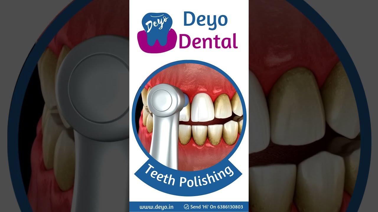 Teeth Polishing Live Video