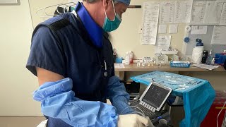 Stroke pain in the shoulder. An easily performed, durable solution. Peripheral nerve stimulation by Anodyne Research 285 views 7 months ago 1 minute, 36 seconds