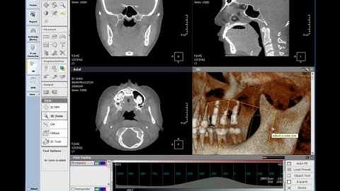 3D Module - 3D Task tool ( MPR / CPR / Zoom )