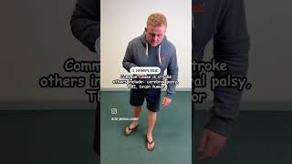 Gait Abnormalities| Types of abnormal gait #gait #gaittraining #abnormalgait #cpchild