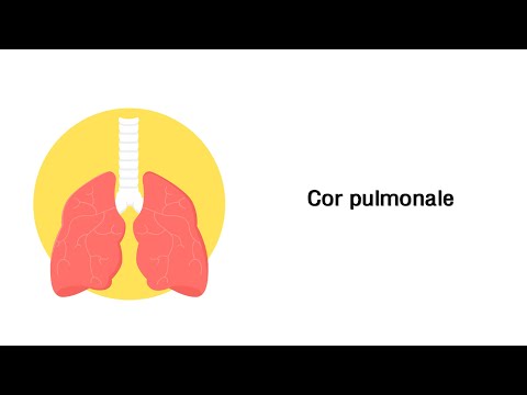 Video: Akute Und Chronische Cor Pulmonale - Symptome, Behandlung