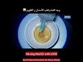 Mixing NaOCl with CHX : by Dr Mazen Doumani &amp; Dr Osama Warda