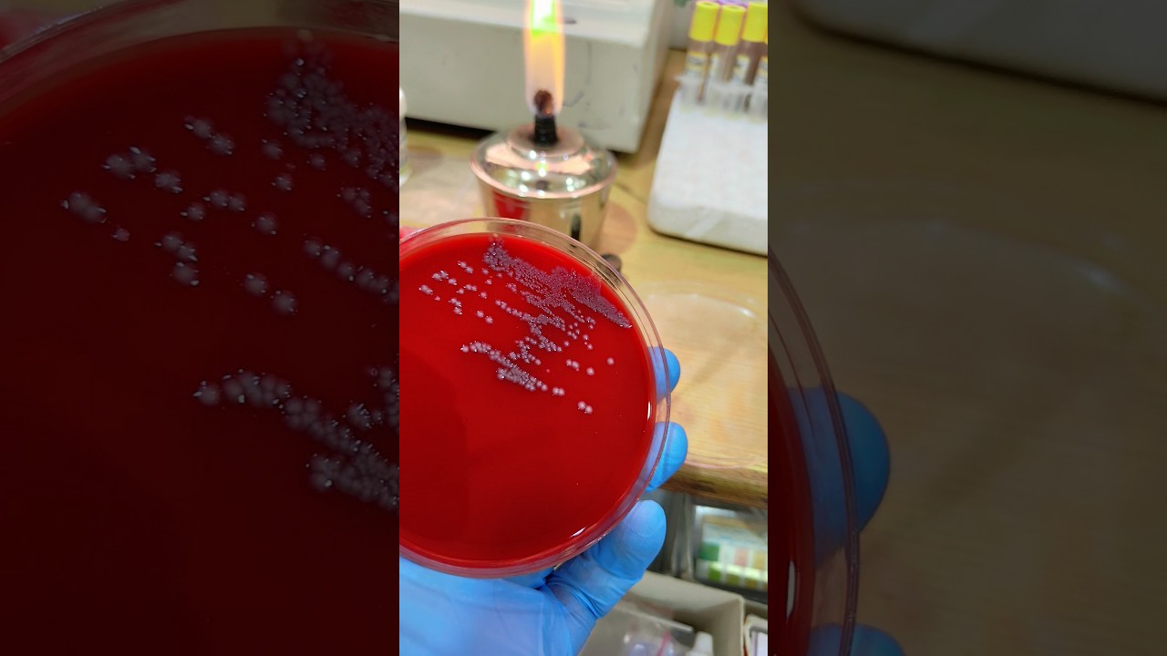 Microbial Growth | How to Count Colony Forming Units | 