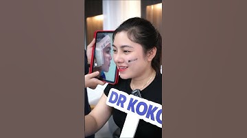 Cải thiện hoàn toàn khuyết điểm đầu mũi ngắn, cánh mũi bè sau 90 phút nâng mũi cấu trúc #nangmui