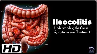 Leocolitis 101 Spotting The Early Warning Signs