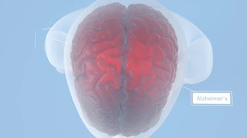 Visium Spatial Gene Expression Solution | Uncover the 