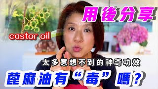 573【家庭必備萬用油】澳洲藥店特別火的蓖麻油太多意想不到的神奇功效從遠古時代就被用於治療各種疾病包括頭髮和皮膚護理。用蓖麻油治療頭髮斷裂和促進頭髮生長早已被公認為替代健康領域