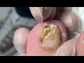 How to cut thick nail - nail skill teaching