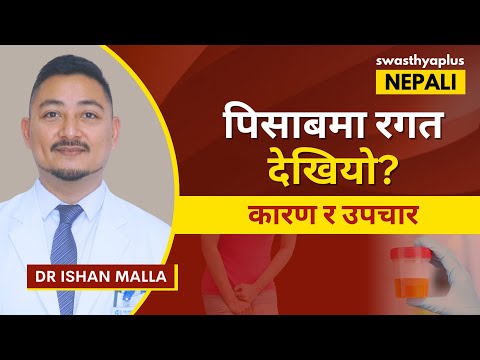 पिसाबमा रगत: कारण र उपचार | Blood in Urine: How to Treat? in Nepali | Hematuria | Dr Ishan Malla
