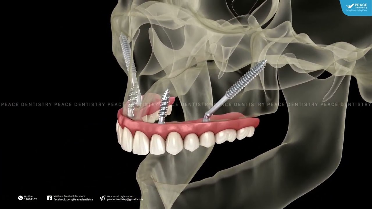 Ảnh 5 của Nha Khoa Peace Dentistry - Quận 1