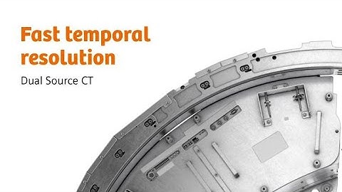 Computed tomography: Dual Source CT - Fast temporal resolution