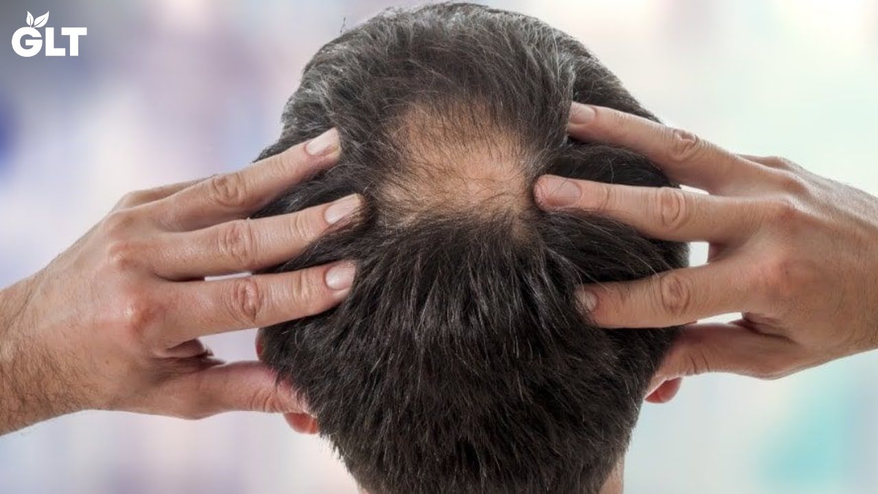 this Is What Happens If You Use Flaxseeds For Hair YouTube