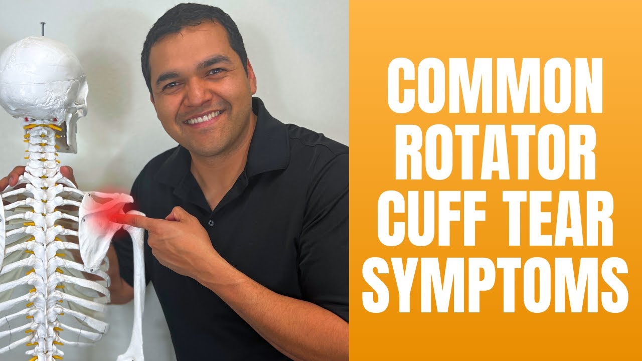 Shoulder Rtc Signs 2 Big Signs You Might Have a Rotator Cuff Tear - YouTube