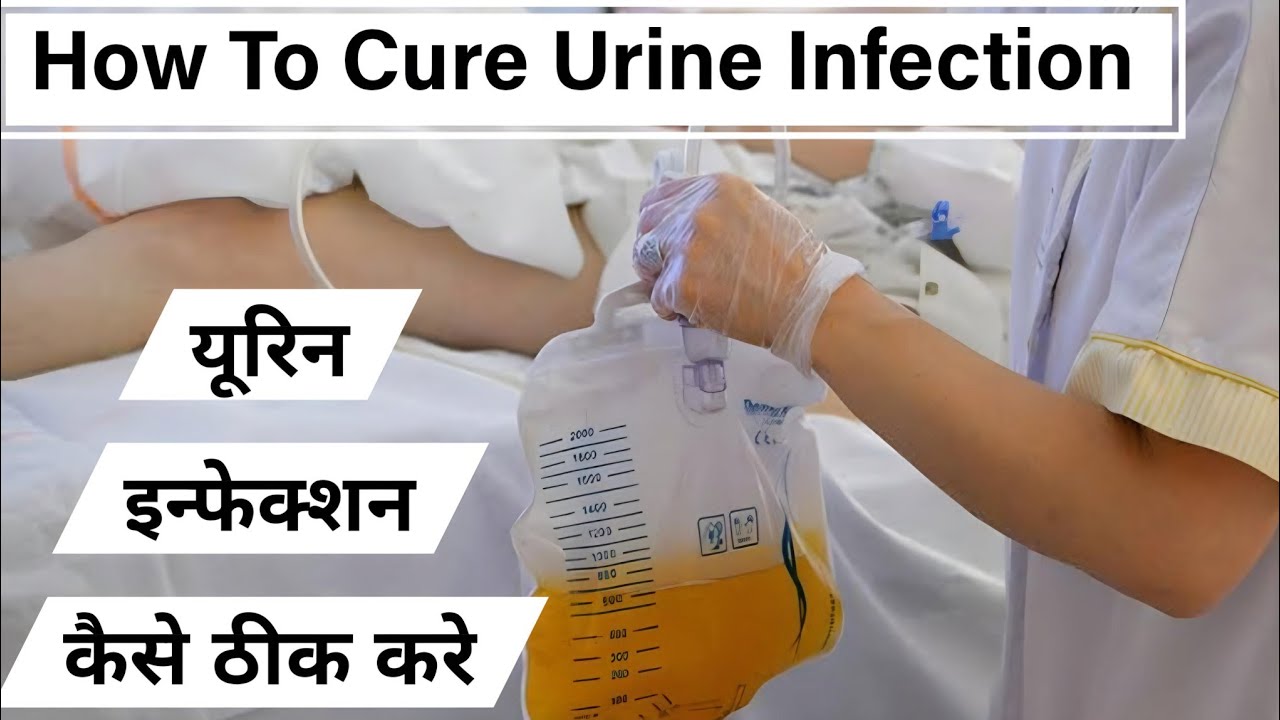 how-i-cured-my-uti-naturally-and-without