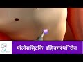 पीसीओडी और उसके उपचार पर आधारित प्रश्नोत्तरी