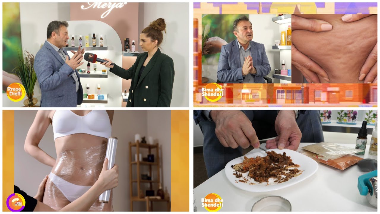 Ylli Merja: Celuliti, ja bimët që bëjnë ‘namin’ në shkrirjen e menjëhershme të tij