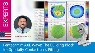 Pentacam® AXL Wave: The Building Block for Specialty Contact Lens Fitting