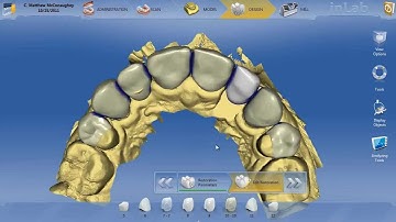 inLAB 4.0  Troubleshooting Tibase out the back of the abutment