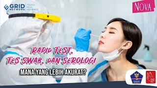 Ini Beda Rapid Test Antigen, Rapid Test Antibodi dan PCR