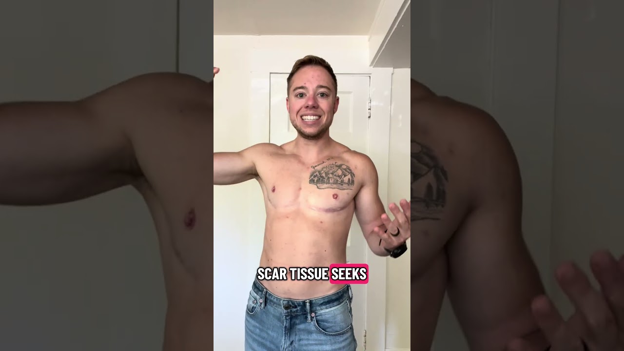 Scar Massage After Surgery | Top Surgery & Beyond (Tips for You + Your Partner)