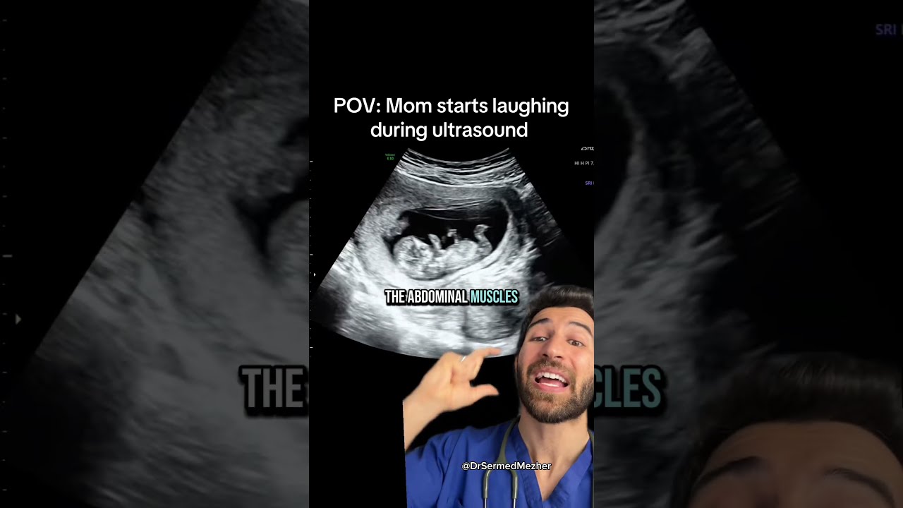  POV You Sneezed While Pregnant Shock