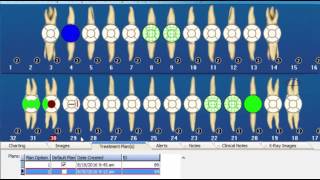 Clinical Charting Part 2 | DentiMax Webinar