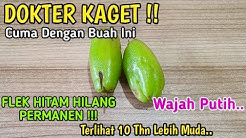 Gunakan Ini,Wajah Putih, Bebas Jerawat dan Flek Hitam Hilang Entah Kemana !!! - Durasi: 5.23. 
