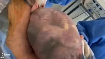 Est-ce que le bébé est dans le placenta ?