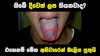 About You From Spots on the Tongue