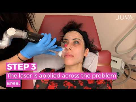 Can Lasers Address My Dark Circles?