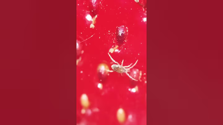 Strawberry 🍓 inside the microscope 🔬#youtubeshorts #shorts #medical