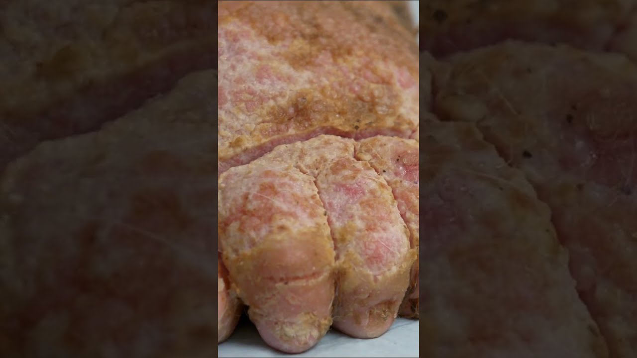 This Woman Found Maggots In Between Her Toes Dr Pimple Popper TLC