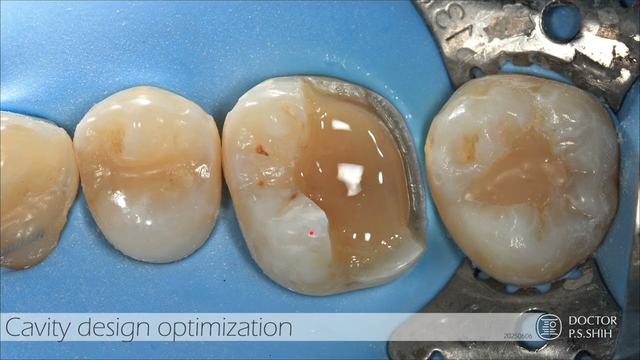 老施教你怎麼使用老施