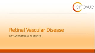OCT Interpretation Session 4: Retinal Vascular Disease