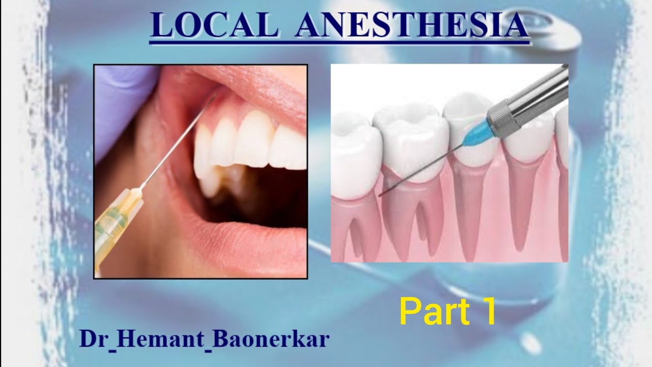 Local Anesthesia Part 1 Lignocaine Lidocaine Bupivacaine Articaine