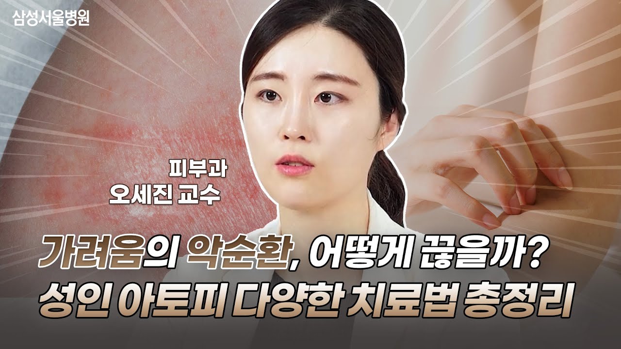 가려움의 악순환, 어떻게 끊을까? 성인 아토피 다양한 치료법 총정리