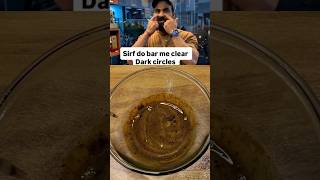 7 Din Mein Dark Circles Gayab 😱 | No Cream, 100% Natural Home Remedy#shorts