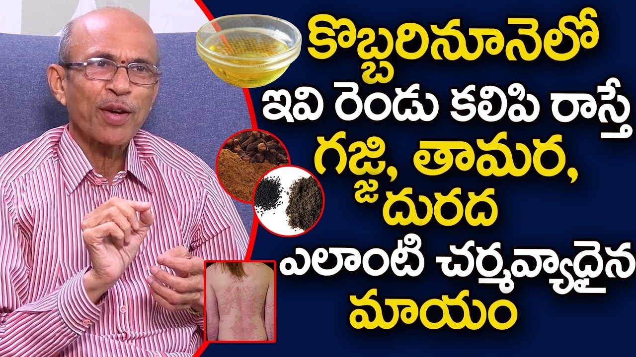 కొబ్బరినూనెలో ఇవి రెండు కలిపి రాస్తే గజ్జి, తామర, దురద మటుమాయం | Remove Ringworm Naturally | iDream