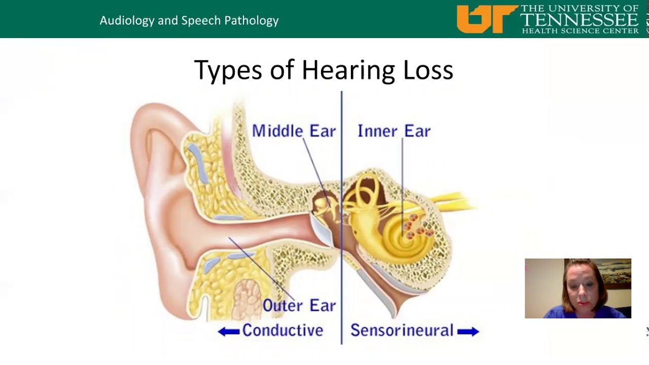 In-service on hearing loss for retirement center staff
