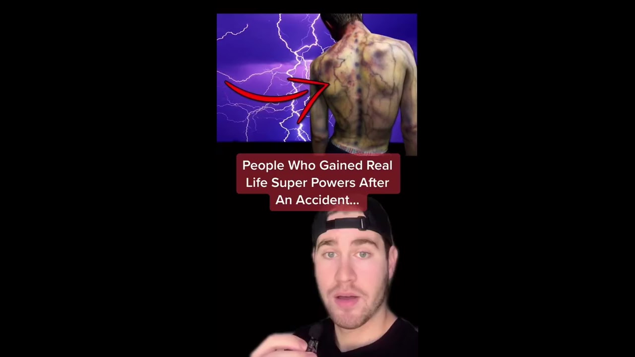 PEOPLE WHO GAINED REAL LIFE SUPER POWERS AFTER AN ACCIDENT Shorts