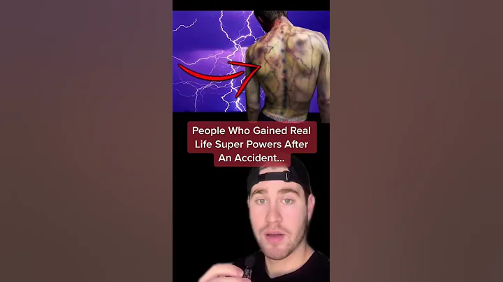 PEOPLE WHO GAINED REAL LIFE SUPER POWERS AFTER AN ACCIDENT!! #Shorts