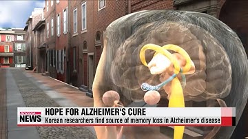 Korean researchers find cause of memory loss in Alzheimer