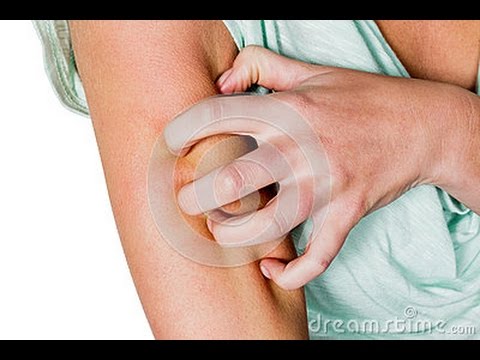 tea tree oil for jock itch - YouTube