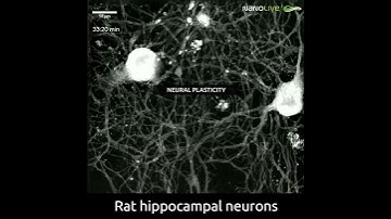 Rat hippocampal neurons imaged with label-free live cell microscope