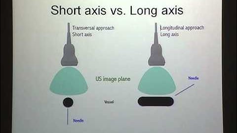 1 Procedures 1 Vascular access Ming Tse Tsai