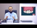 أنواع زراعة الأسنان وأفضلها 